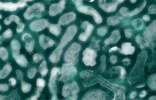 microscope_h5n1virus microscope_h5n1virus
