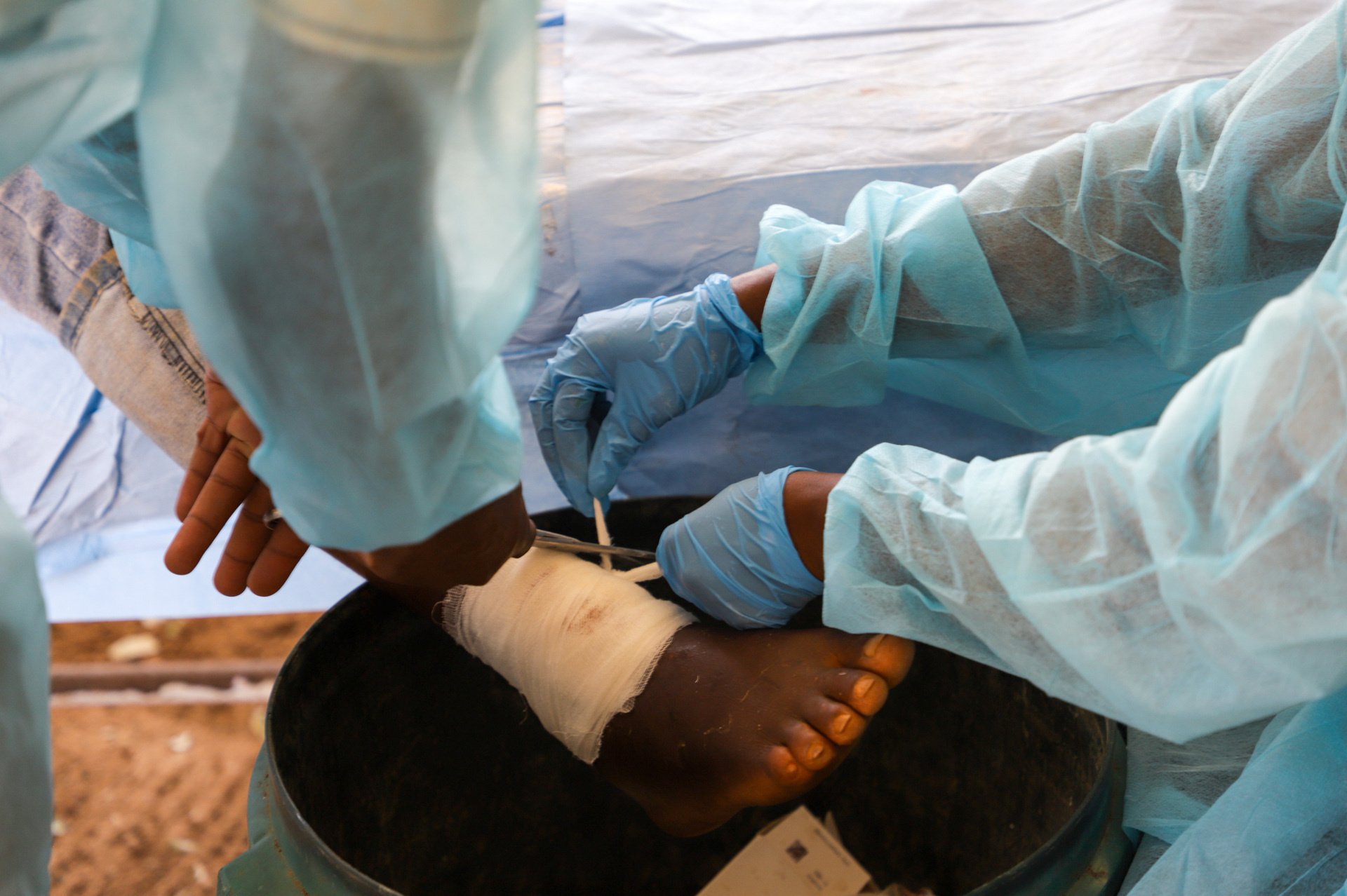 Wound management