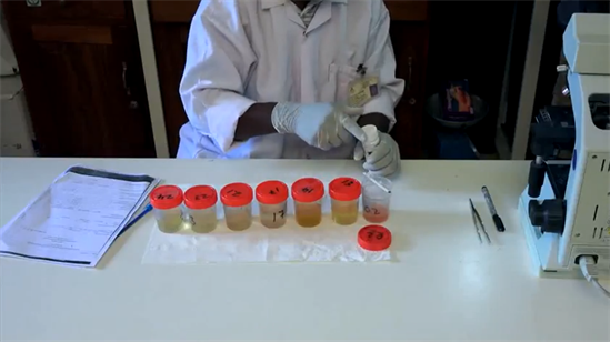 Urine-tests-visual-haematuria-reagent-strip-and-filtration