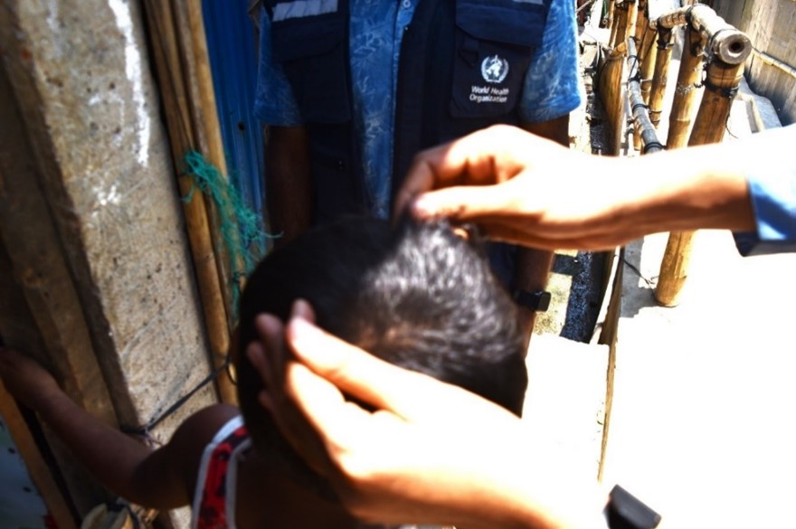 examination for head lice