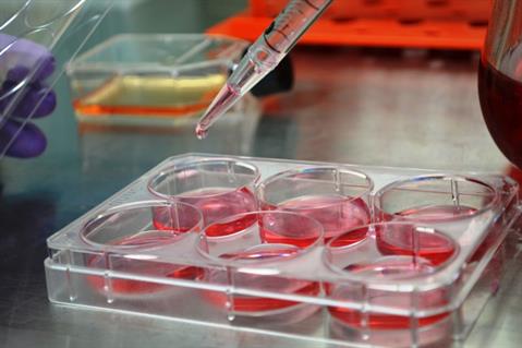 WHO Recommendations on SARS and Blood Safety