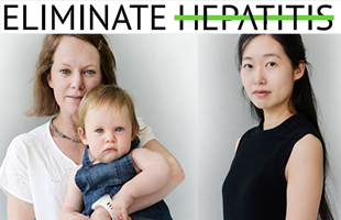Firm action is needed to eliminate viral hepatitis in Viet Nam